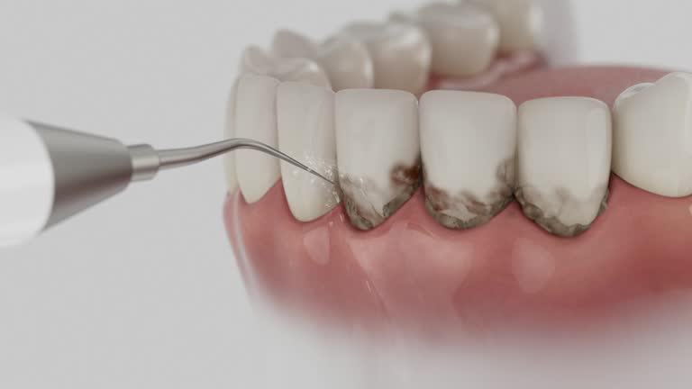 Trusted Teeth Cleaning And Checkup service in Great Falls Crossing, VA - Dentist Open Now